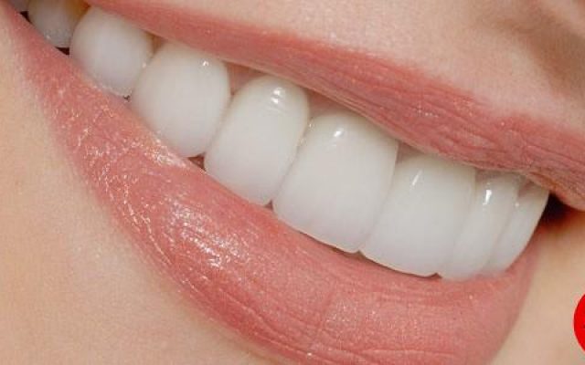 خوراکی هایی که باعث زرد شدن دندانهایتان می‌شوند+ اینفوگرافی