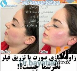 پزشک متخصص پوست و مو زیبایی دارای پروانه مطب تهران و استانبول