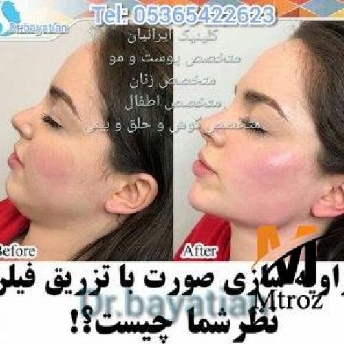 پزشک متخصص پوست و مو زیبایی دارای پروانه مطب تهران و استانبول
